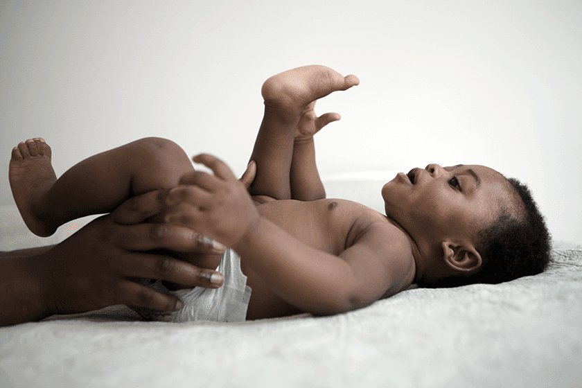 Baby with diaper rash being treated gently